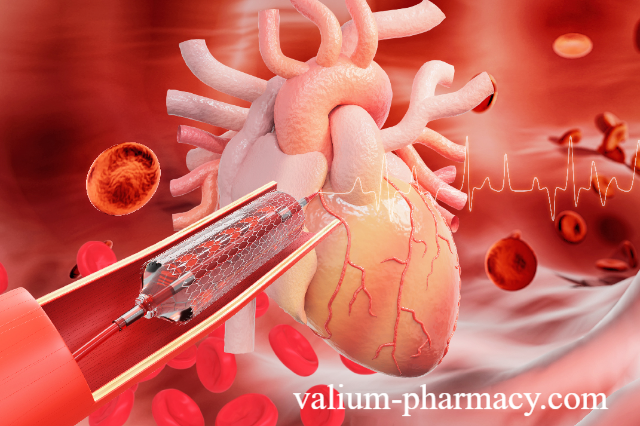 Penyebab dan Pencegahan Penyakit Jantung Koroner - Penyakit jantung dalam istilah medis di sebut penyakit jantung koroner