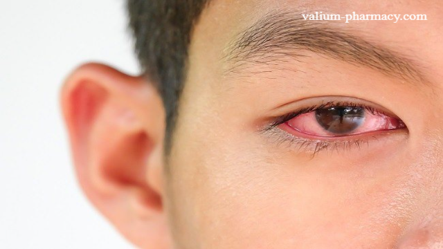 Penyakit Mata: Ciri-Ciri dan Gejala yang Perlu Diperhatikan